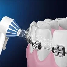 A close-up animated diagram shows a water flosser jet cleaning around braces on teeth and gums.